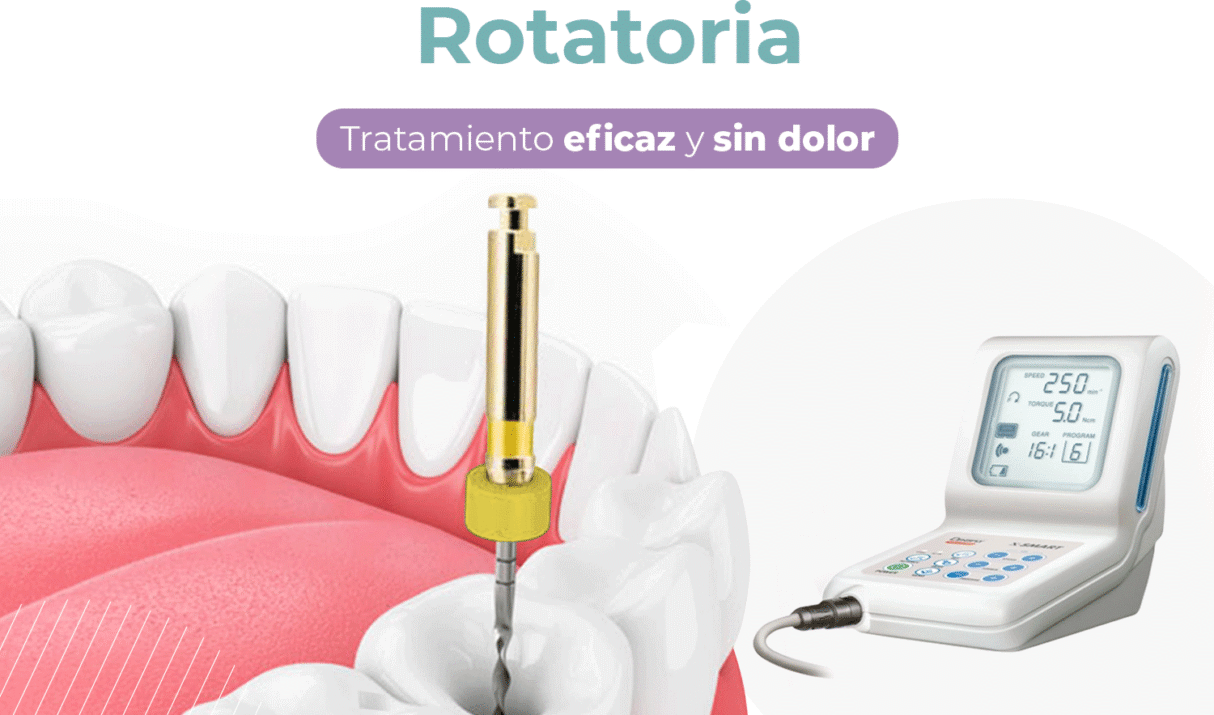 Endodoncia Rotatoria Moderna en Arequipa, Mollendo: La Evolución del Tratamiento de Conducto