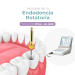 Endodoncia rotatoria Moderna en Arequipa, Mollendo, Endodoncia especializada sin dolor en Arequipa, Mollendo, Perú