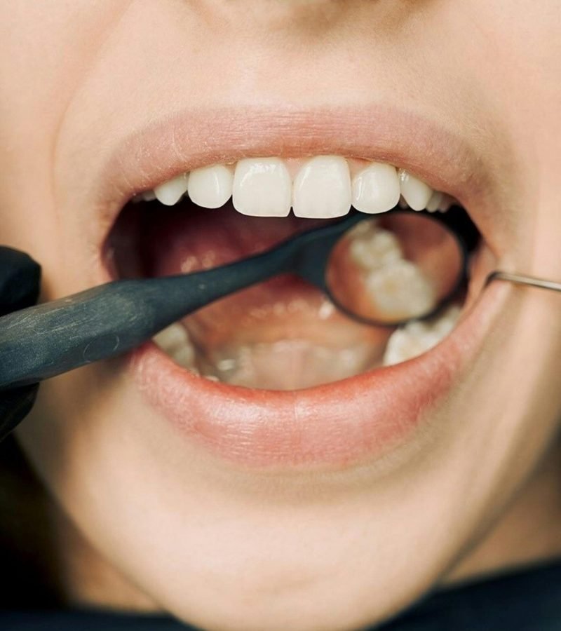 Dr. Carlos Carpio el mejor especialista en endodoncia Arequipa